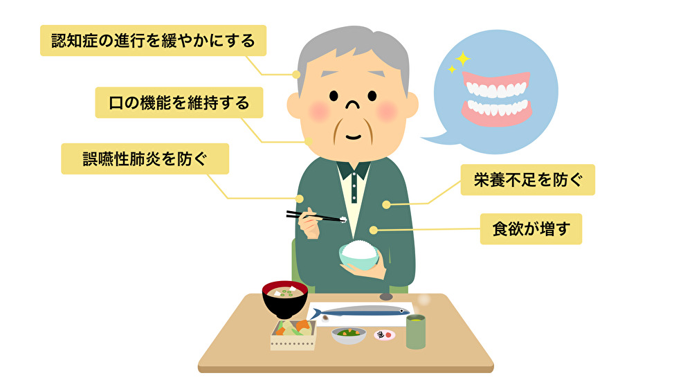 認知症の進行を緩やかにする、口の機能を維持する、誤嚥性肺炎を防ぐ、栄養不足を防ぐ、食欲が増す